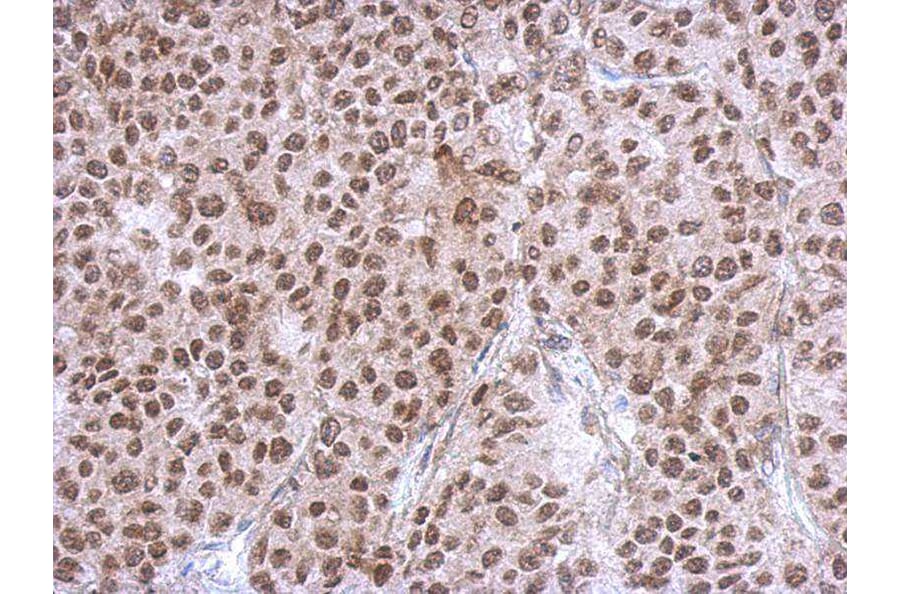 Immunohistochemistry - RBM4 antibody from Signalway Antibody (22419) - Antibodies.com