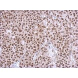 Immunohistochemistry - RBM4 antibody from Signalway Antibody (22419) - Antibodies.com