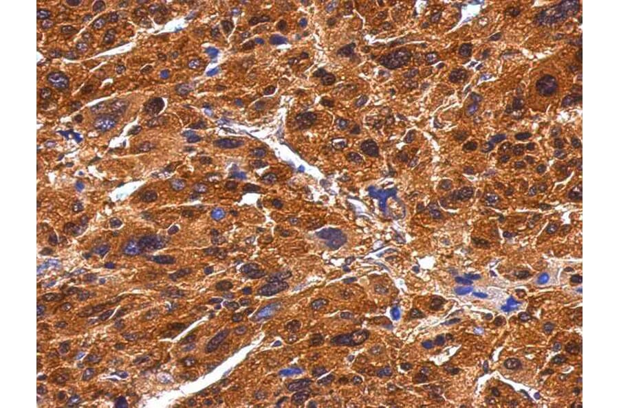 Immunohistochemistry - BIVM antibody from Signalway Antibody (22428) - Antibodies.com