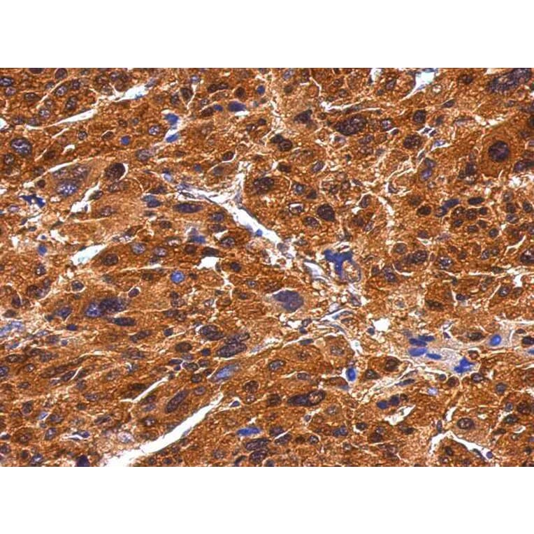 Immunohistochemistry - BIVM antibody from Signalway Antibody (22428) - Antibodies.com