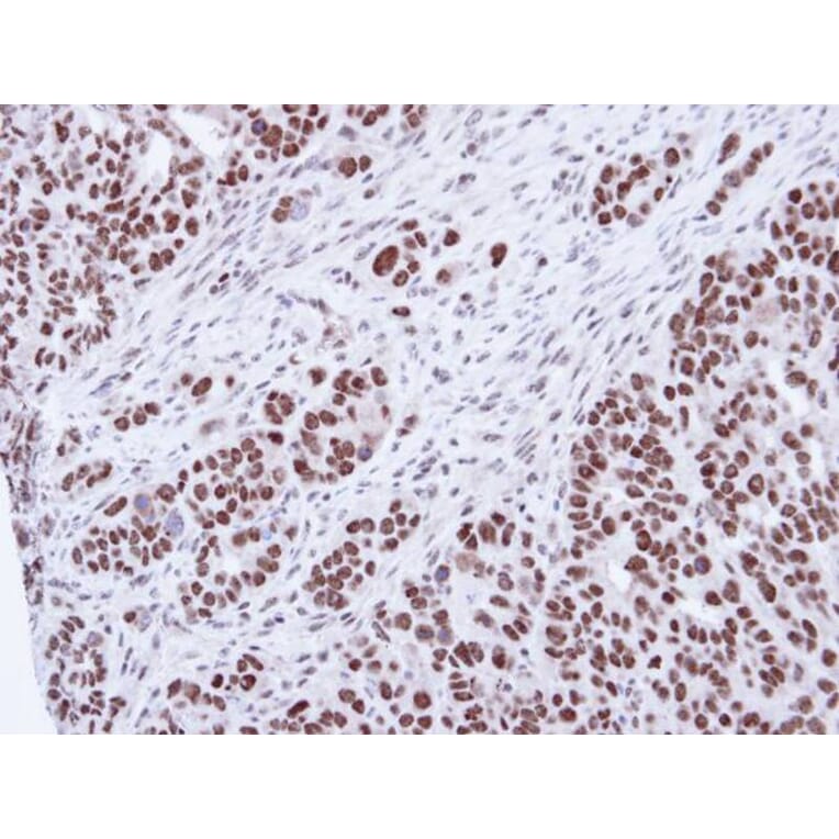 Immunohistochemistry - SNRK antibody from Signalway Antibody (22477) - Antibodies.com