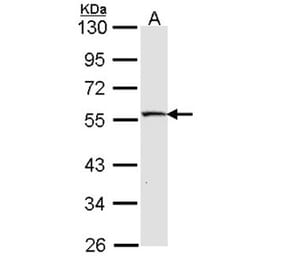 MST4 antibody from Signalway Antibody (22486) - Antibodies.com