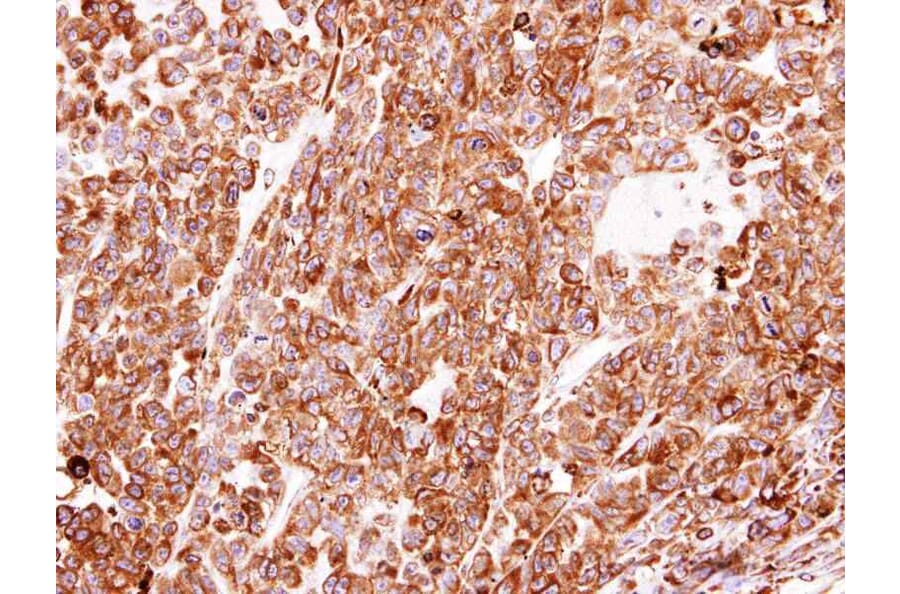 Immunohistochemistry - PDI antibody from Signalway Antibody (22520) - Antibodies.com