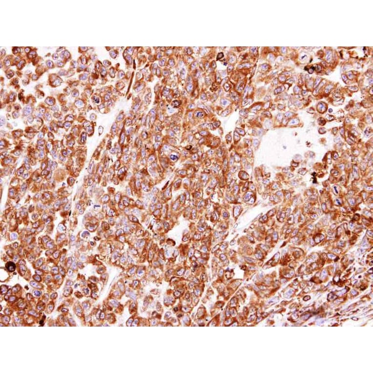 Immunohistochemistry - PDI antibody from Signalway Antibody (22520) - Antibodies.com