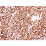 Immunohistochemistry - PDI antibody from Signalway Antibody (22520) - Antibodies.com