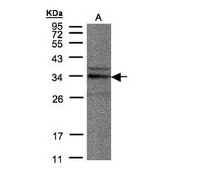NEK7 antibody from Signalway Antibody (22546) - Antibodies.com