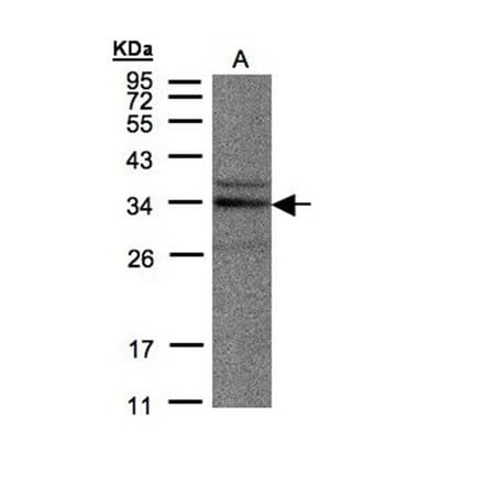 NEK7 antibody from Signalway Antibody (22546) - Antibodies.com