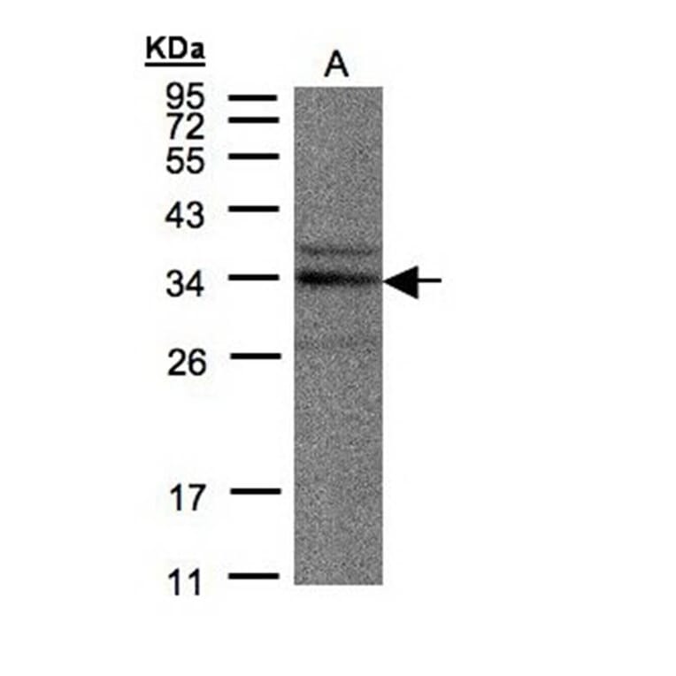 NEK7 antibody from Signalway Antibody (22546) - Antibodies.com