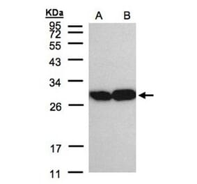 TPI1 antibody from Signalway Antibody (22576) - Antibodies.com