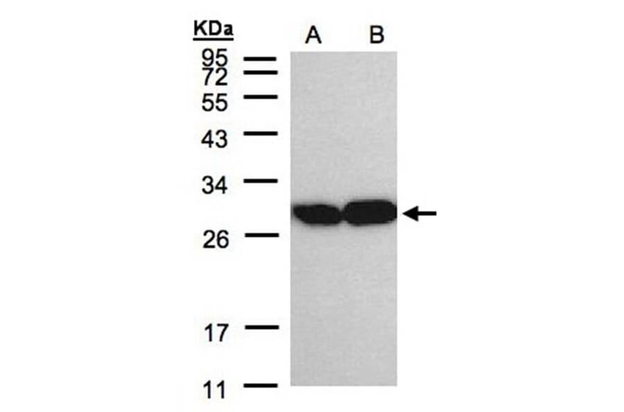 TPI1 antibody from Signalway Antibody (22576) - Antibodies.com