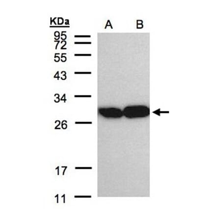 TPI1 antibody from Signalway Antibody (22576) - Antibodies.com