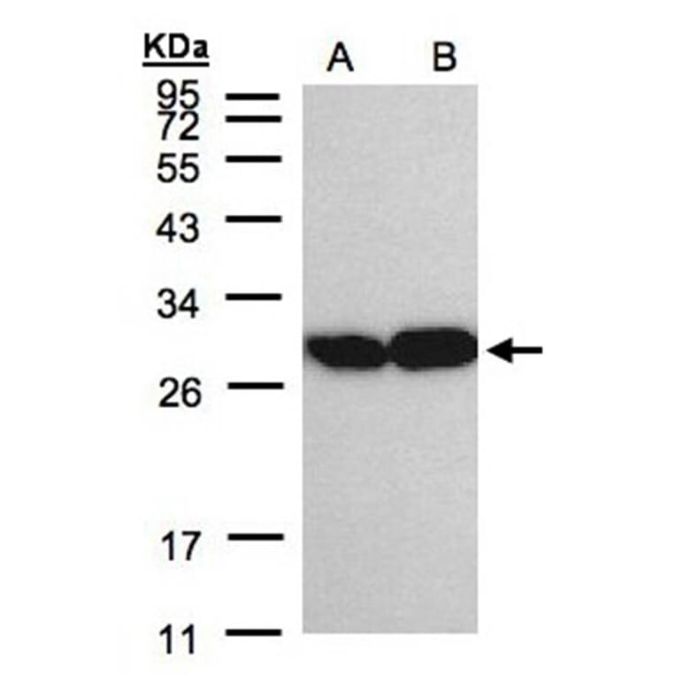 TPI1 antibody from Signalway Antibody (22576) - Antibodies.com