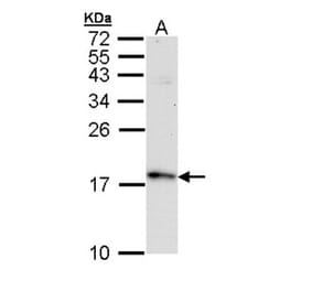 FIS1 antibody from Signalway Antibody (22631) - Antibodies.com