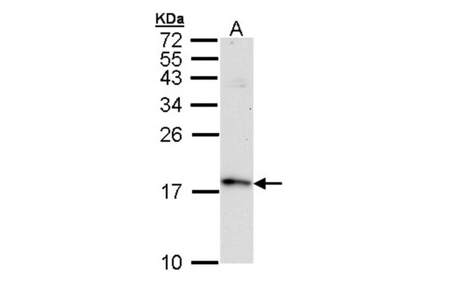 FIS1 antibody from Signalway Antibody (22631) - Antibodies.com