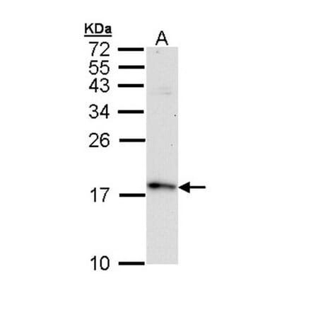 FIS1 antibody from Signalway Antibody (22631) - Antibodies.com