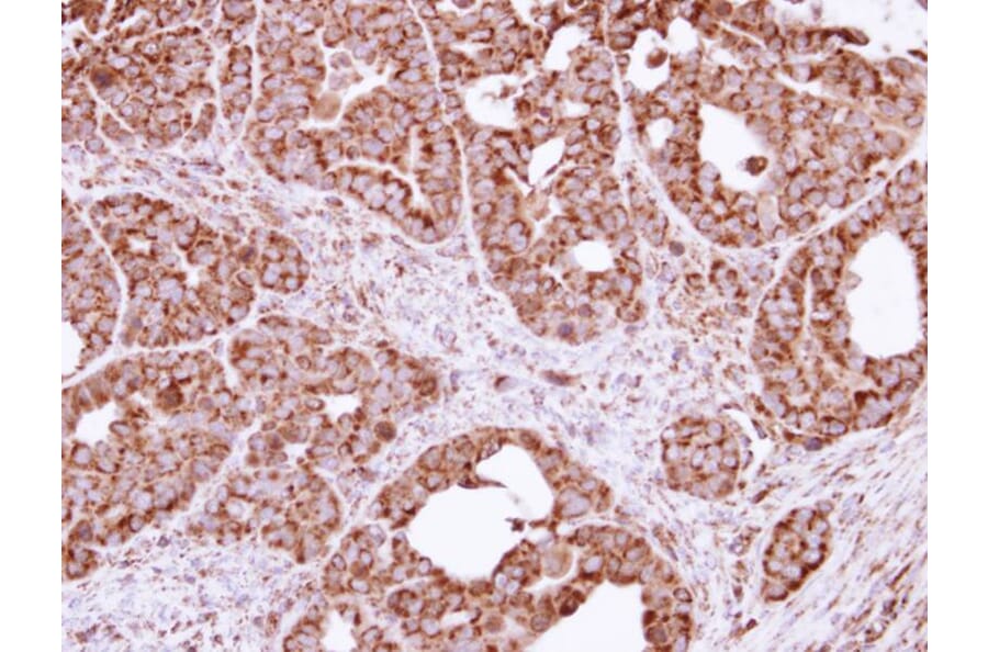 Immunohistochemistry - FIS1 antibody from Signalway Antibody (22631) - Antibodies.com
