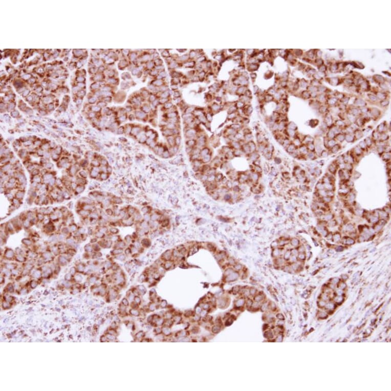 Immunohistochemistry - FIS1 antibody from Signalway Antibody (22631) - Antibodies.com