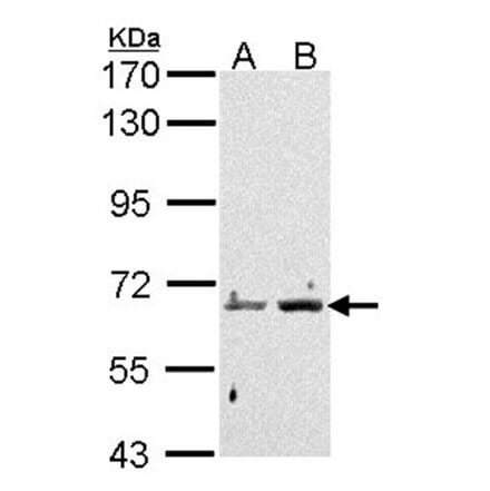 PAD4 antibody from Signalway Antibody (22652) - Antibodies.com