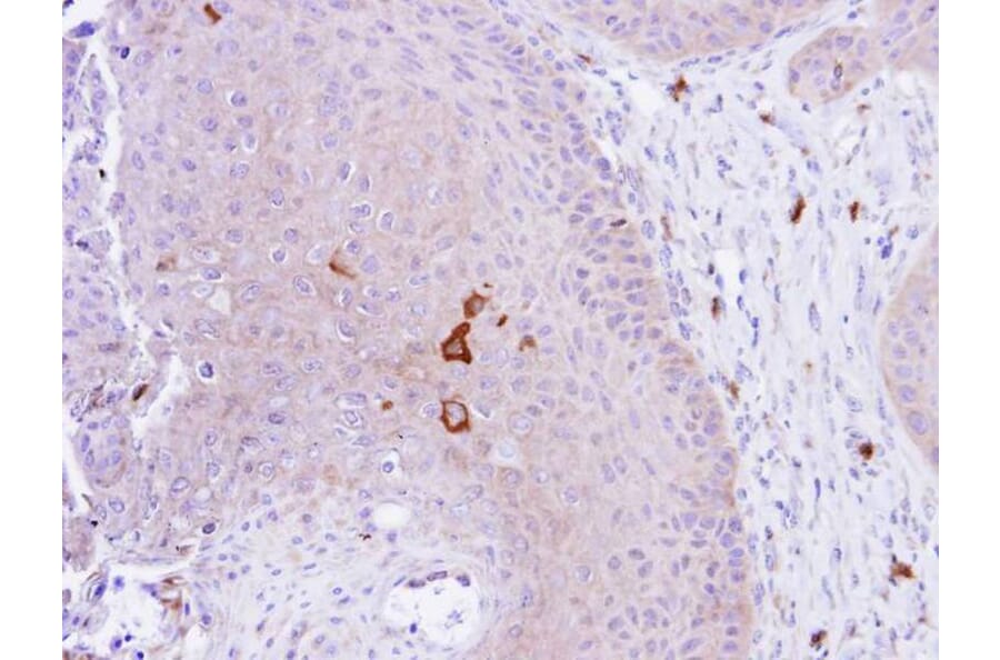 Immunohistochemistry - PAD4 antibody from Signalway Antibody (22652) - Antibodies.com