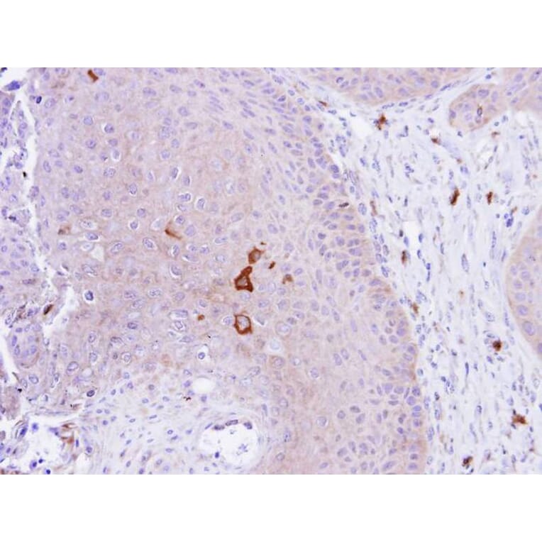 Immunohistochemistry - PAD4 antibody from Signalway Antibody (22652) - Antibodies.com