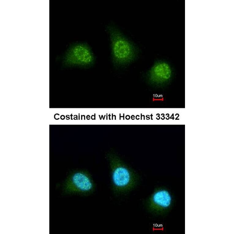 Immunofluorescence - PAD4 antibody from Signalway Antibody (22652) - Antibodies.com