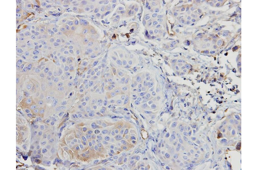 Immunohistochemistry - ARAF antibody from Signalway Antibody (22653) - Antibodies.com