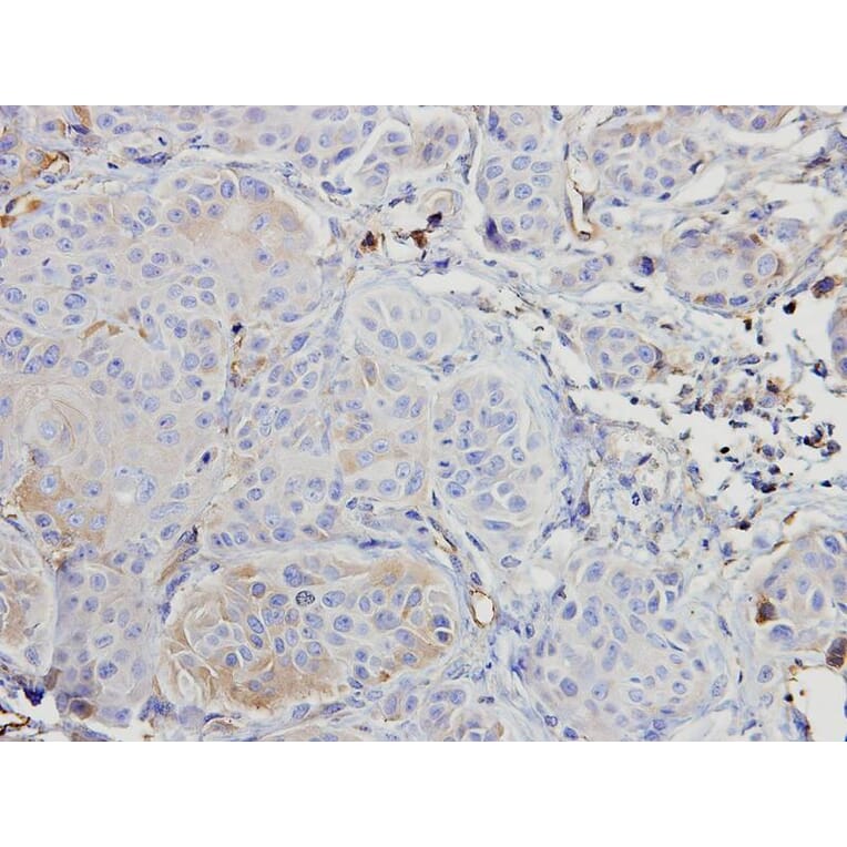 Immunohistochemistry - ARAF antibody from Signalway Antibody (22653) - Antibodies.com