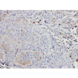Immunohistochemistry - ARAF antibody from Signalway Antibody (22653) - Antibodies.com