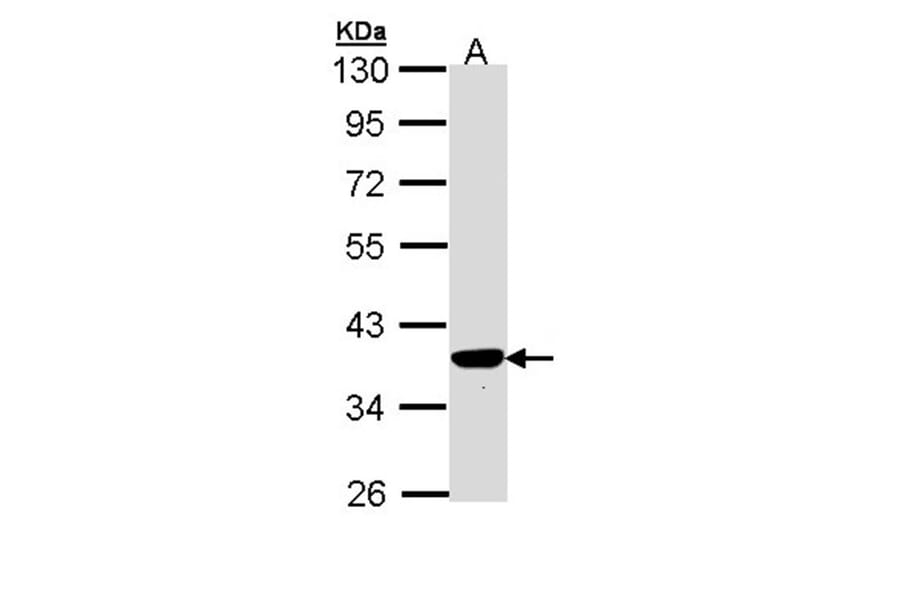 PIG3 antibody from Signalway Antibody (22678) - Antibodies.com