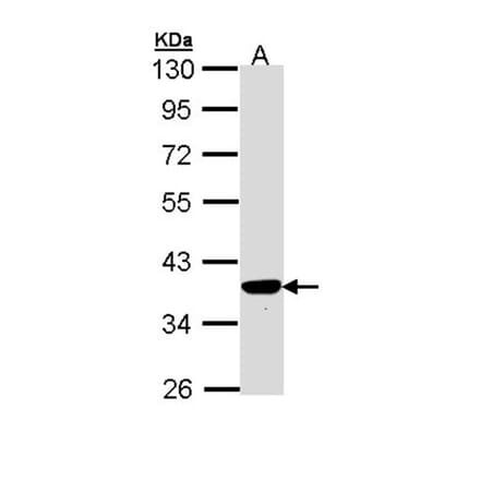 PIG3 antibody from Signalway Antibody (22678) - Antibodies.com