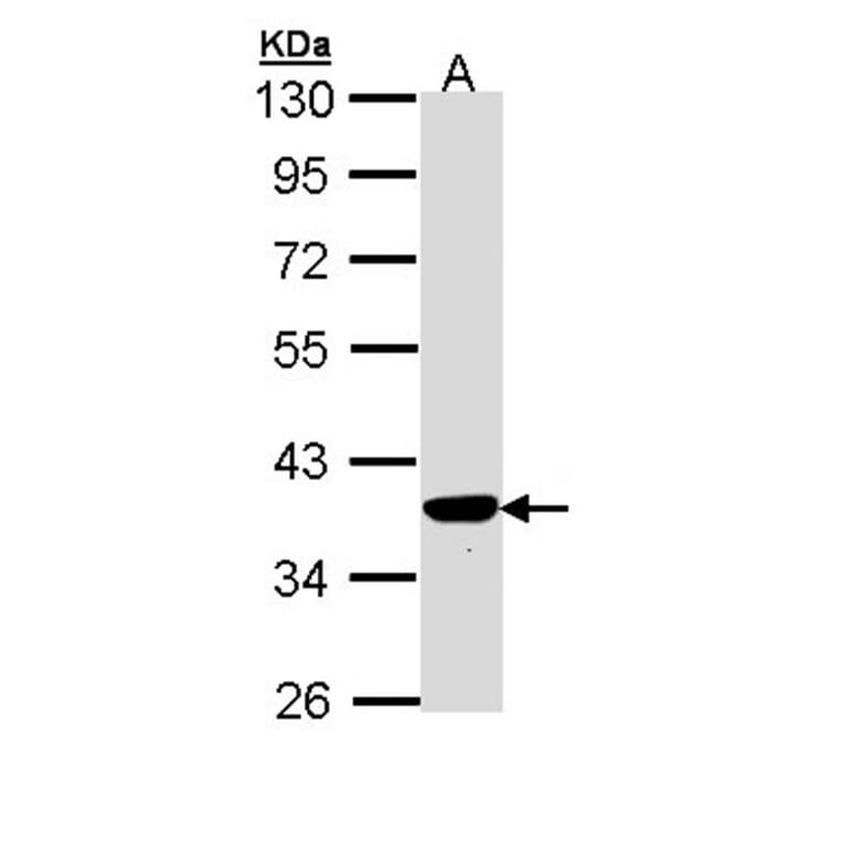 PIG3 antibody from Signalway Antibody (22678) - Antibodies.com