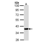 PIG3 antibody from Signalway Antibody (22678) - Antibodies.com