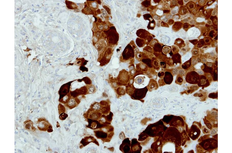 Immunohistochemistry - PIG3 antibody from Signalway Antibody (22678) - Antibodies.com