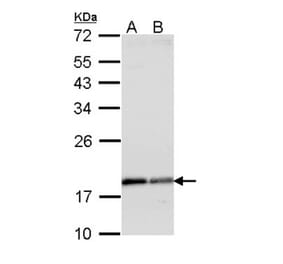 ARF1 antibody from Signalway Antibody (22693) - Antibodies.com
