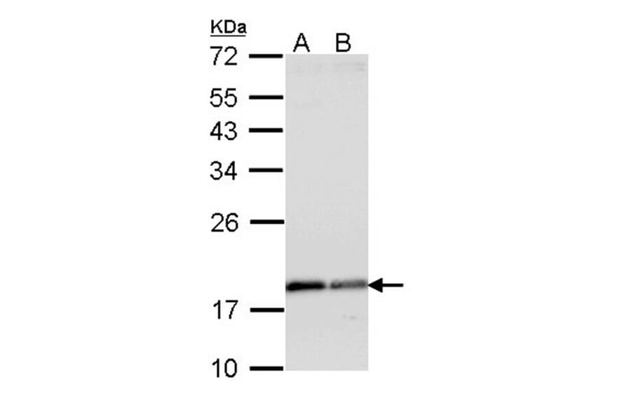 ARF1 antibody from Signalway Antibody (22693) - Antibodies.com