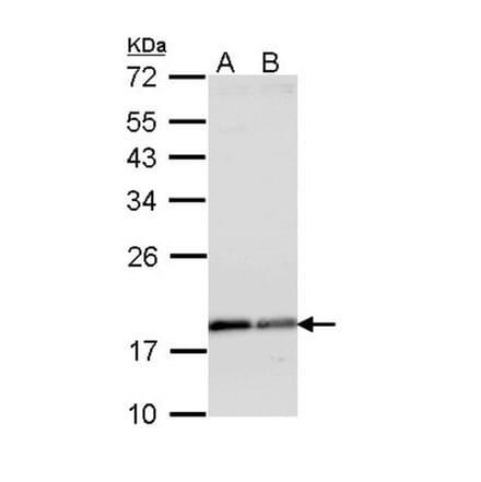 ARF1 antibody from Signalway Antibody (22693) - Antibodies.com