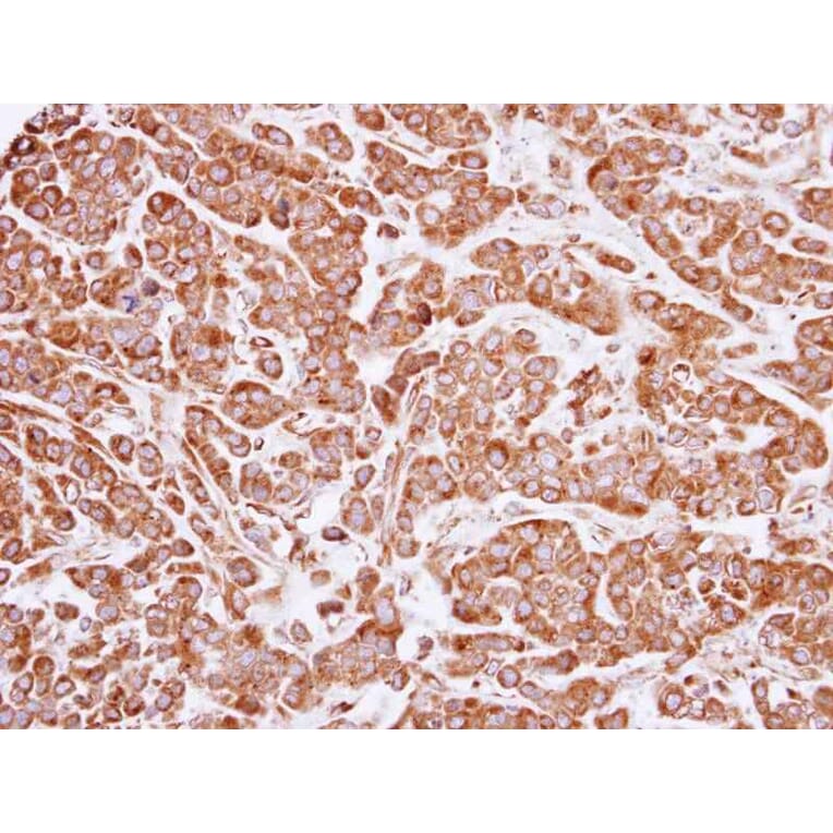 Immunohistochemistry - ARF1 antibody from Signalway Antibody (22693) - Antibodies.com