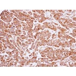 Immunohistochemistry - ARF1 antibody from Signalway Antibody (22693) - Antibodies.com