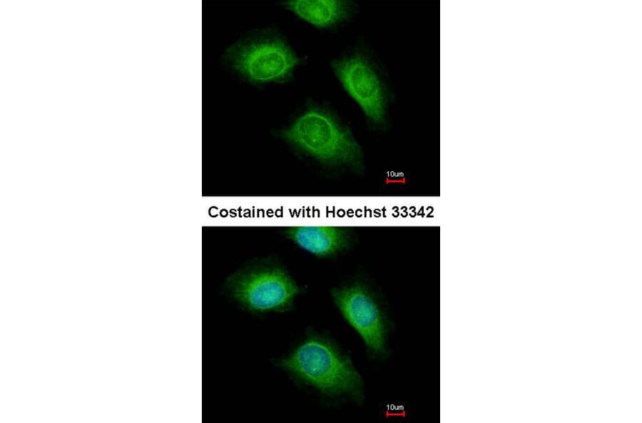 Immunofluorescence - ARF1 antibody from Signalway Antibody (22693) - Antibodies.com