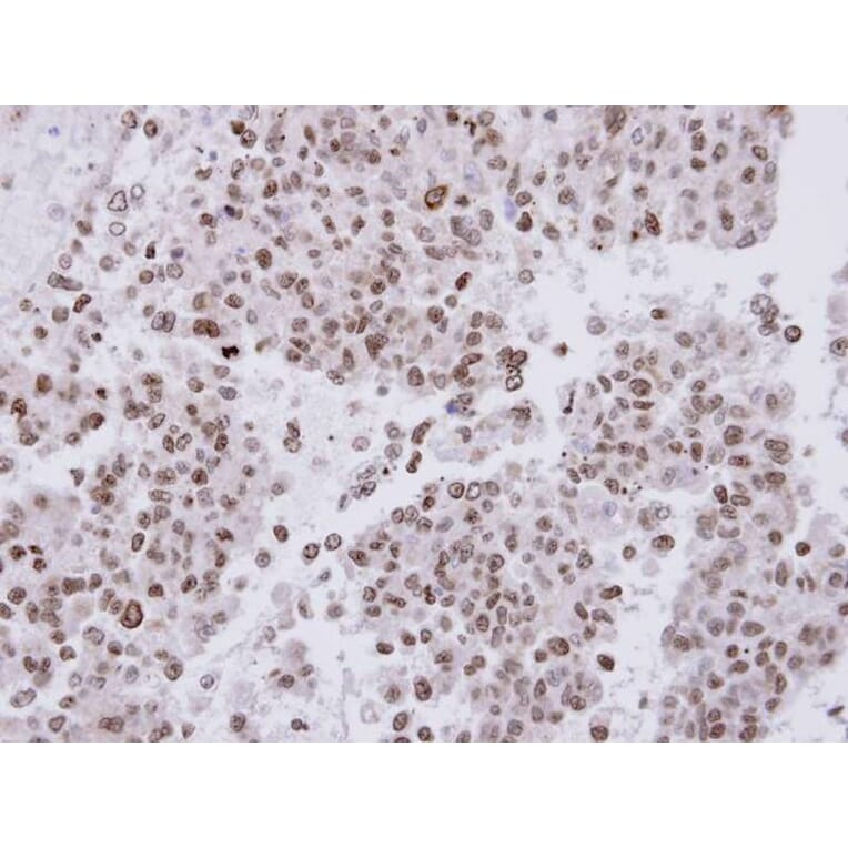 Immunohistochemistry - FACA antibody from Signalway Antibody (22716) - Antibodies.com