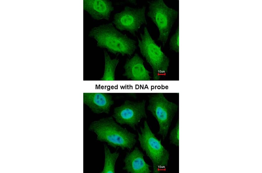 Immunofluorescence - FACA antibody from Signalway Antibody (22716) - Antibodies.com