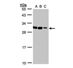 ASB9 antibody from Signalway Antibody (22728) - Antibodies.com