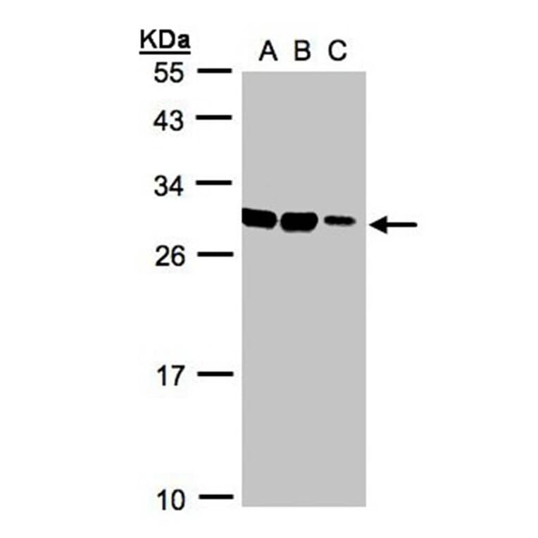ASB9 antibody from Signalway Antibody (22728) - Antibodies.com