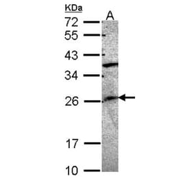 GRAP antibody from Signalway Antibody (22735) - Antibodies.com