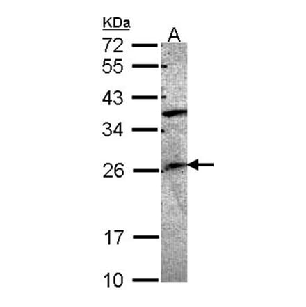 GRAP antibody from Signalway Antibody (22735) - Antibodies.com