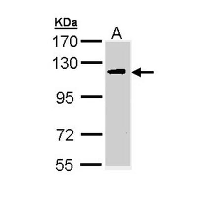 ULK2 antibody from Signalway Antibody (22739) - Antibodies.com