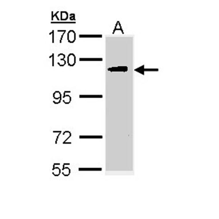 ULK2 antibody from Signalway Antibody (22739) - Antibodies.com