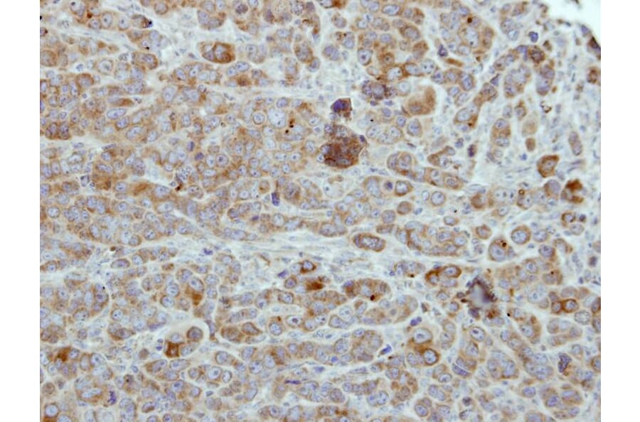 Immunohistochemistry - ULK2 antibody from Signalway Antibody (22739) - Antibodies.com