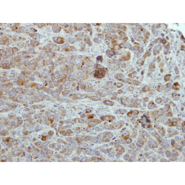 Immunohistochemistry - ULK2 antibody from Signalway Antibody (22739) - Antibodies.com