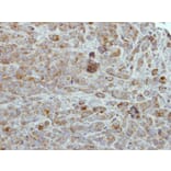 Immunohistochemistry - ULK2 antibody from Signalway Antibody (22739) - Antibodies.com